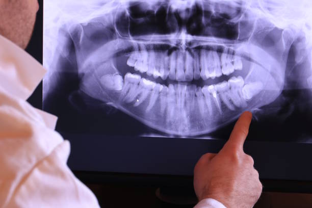 Best Knocked-Out Tooth Emergency  in Candler Mcafee, GA