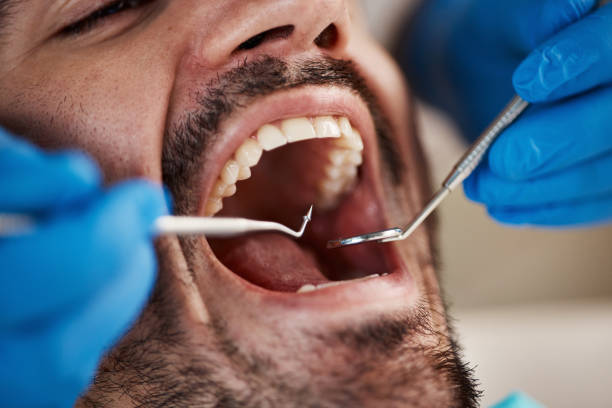 Best Teeth Whitening  in Candler Mcafee, GA